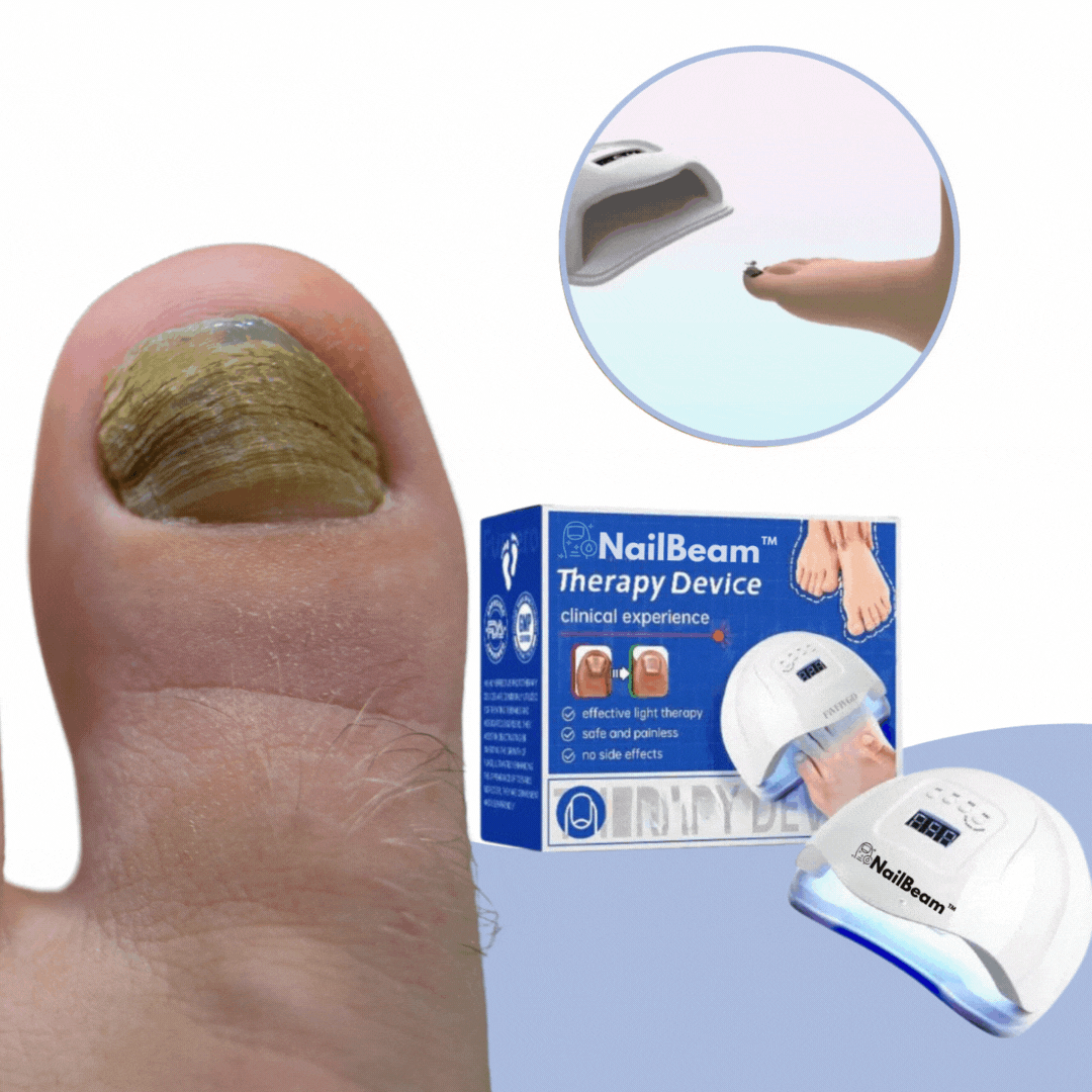 NailBeam™ | Éliminez les champignons des ongles en 7 jours !