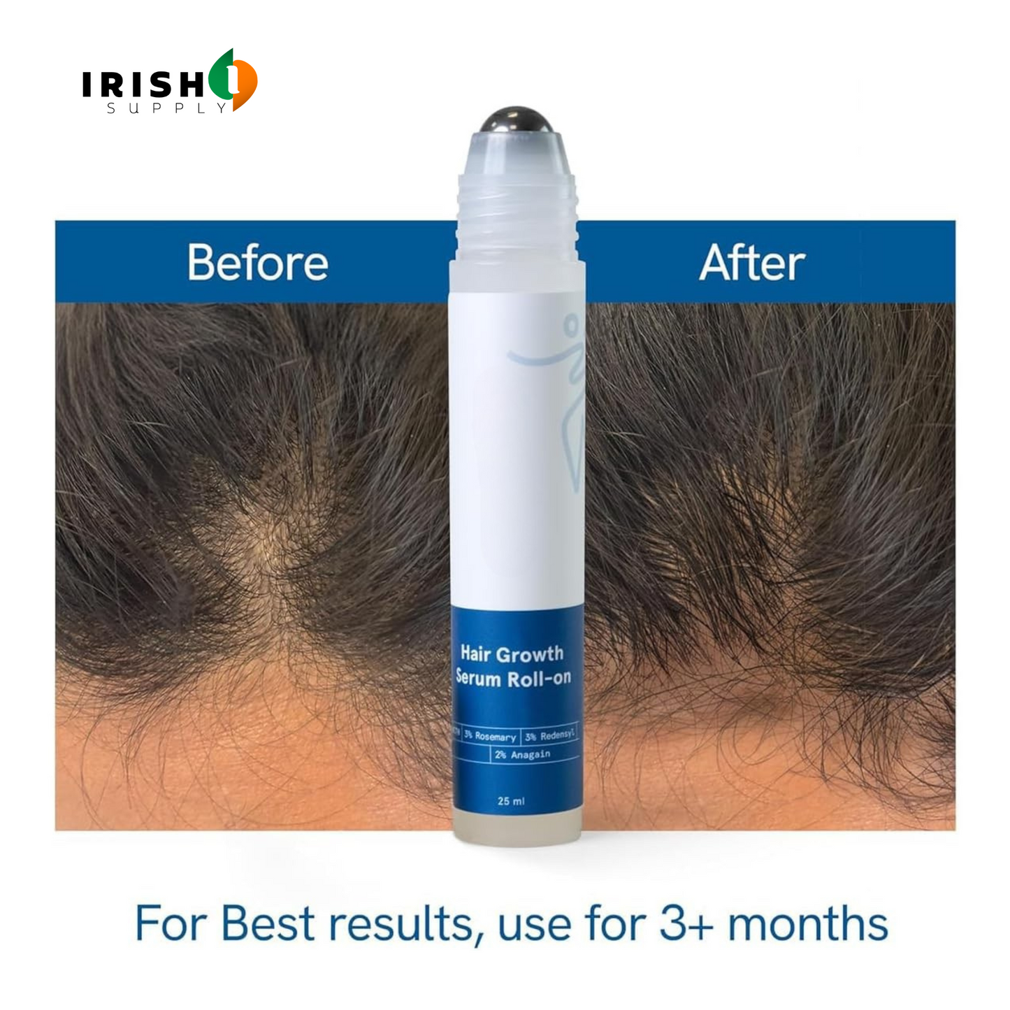 REVIFOL Hair Growth Roll On 25ml