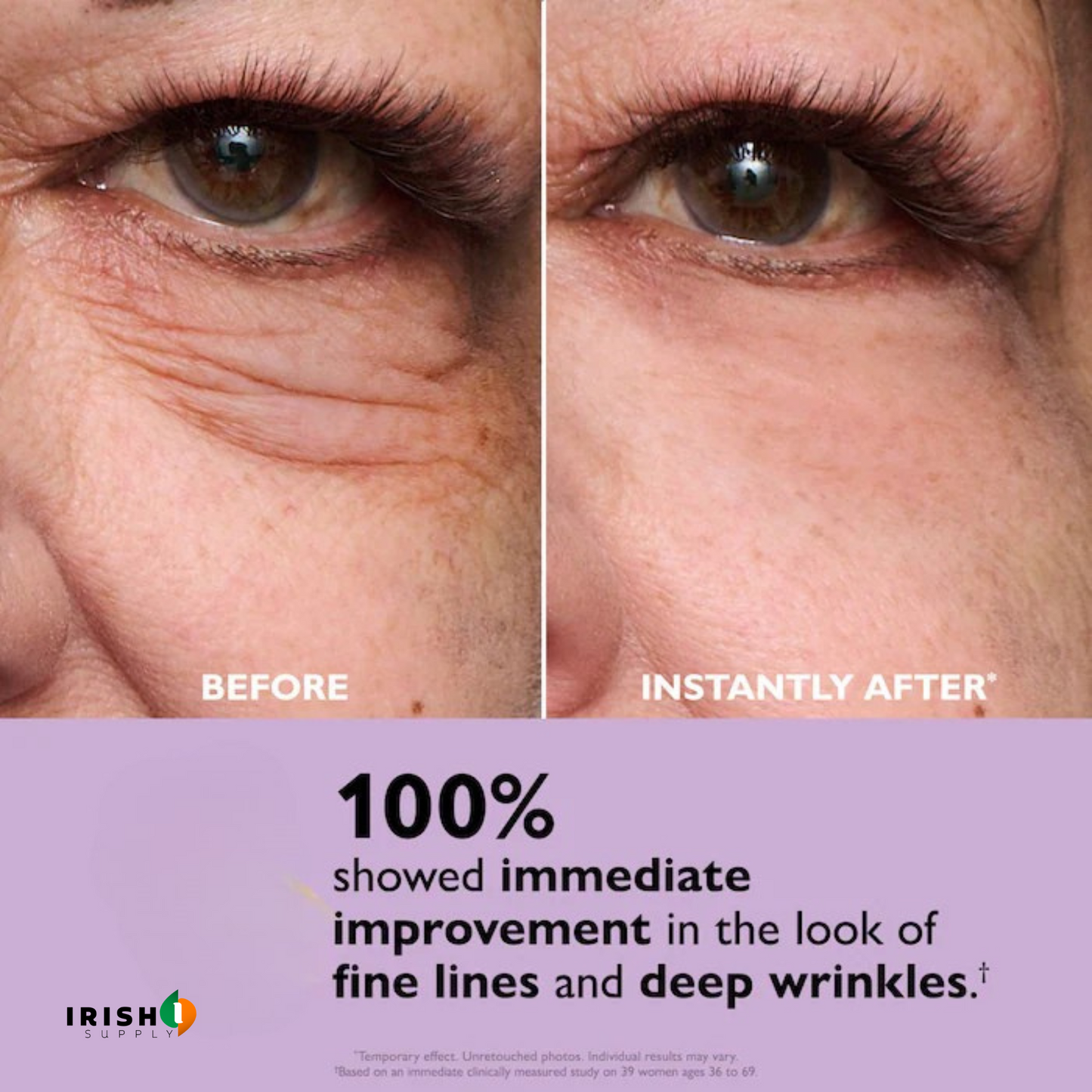 GLAMGAZE Premium Under-Eye Repair Gel