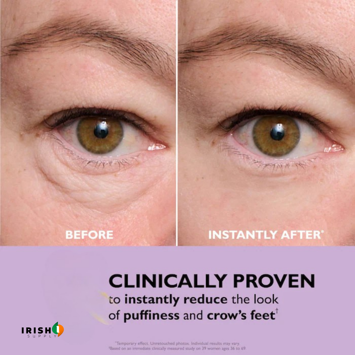 GLAMGAZE Premium Under-Eye Repair Gel