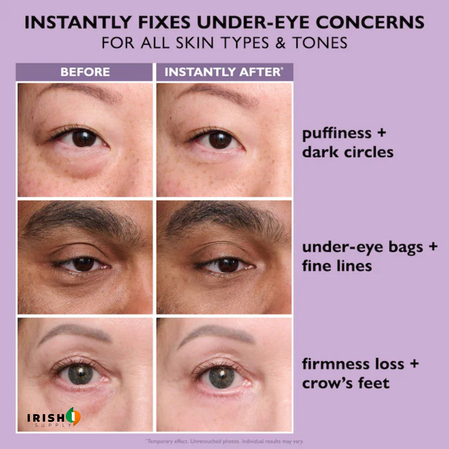 GLAMGAZE Premium Under-Eye Repair Gel