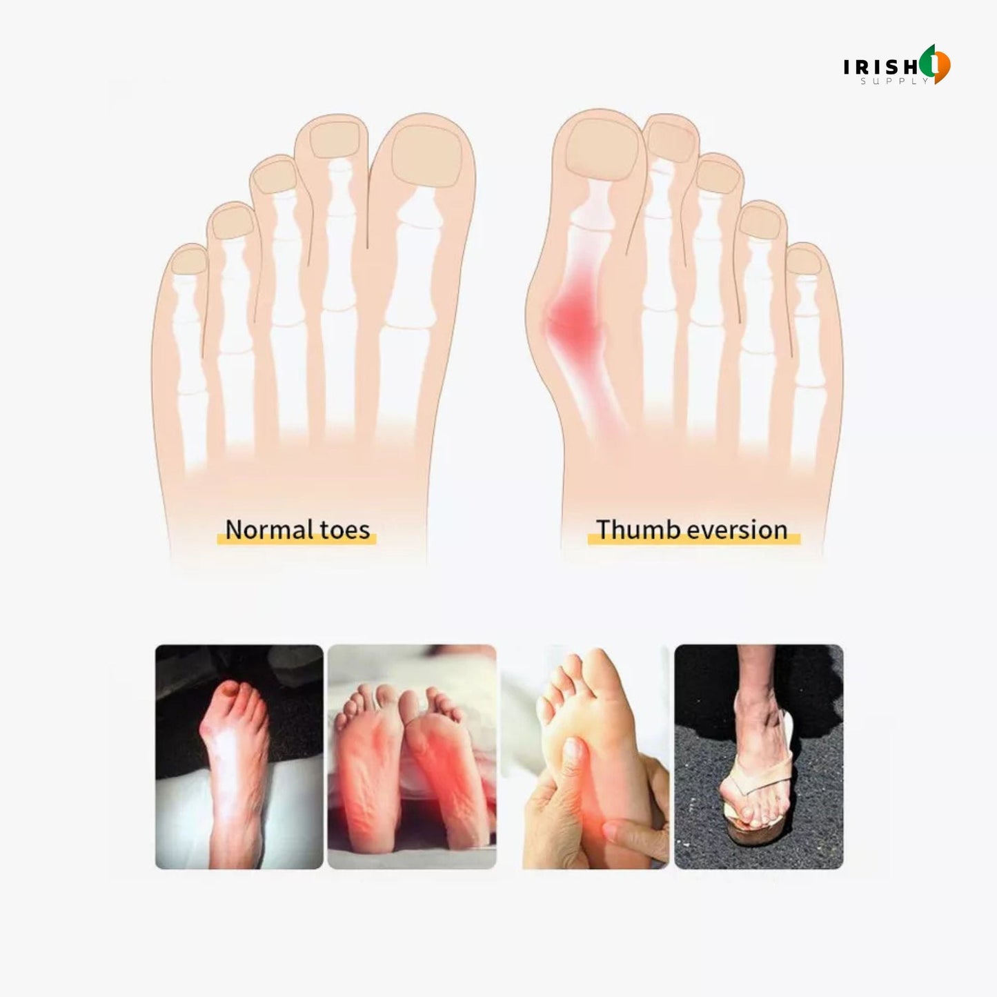 ORTHOSEAL Medical-Grade Foot Alignment Sleeve