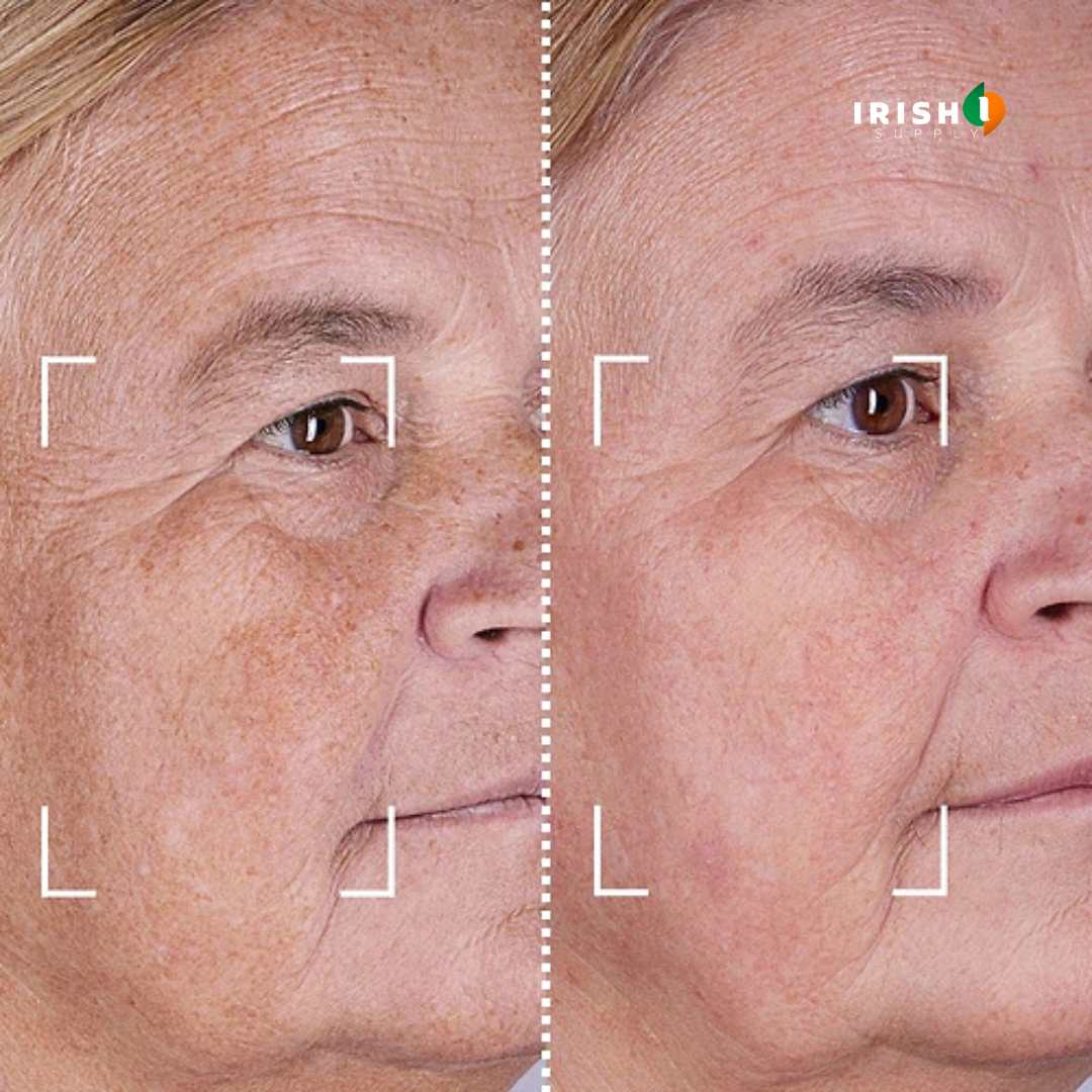 GLOWFORMA 7 LED Light Therapy Skin Rejuvenation Silicone Mask