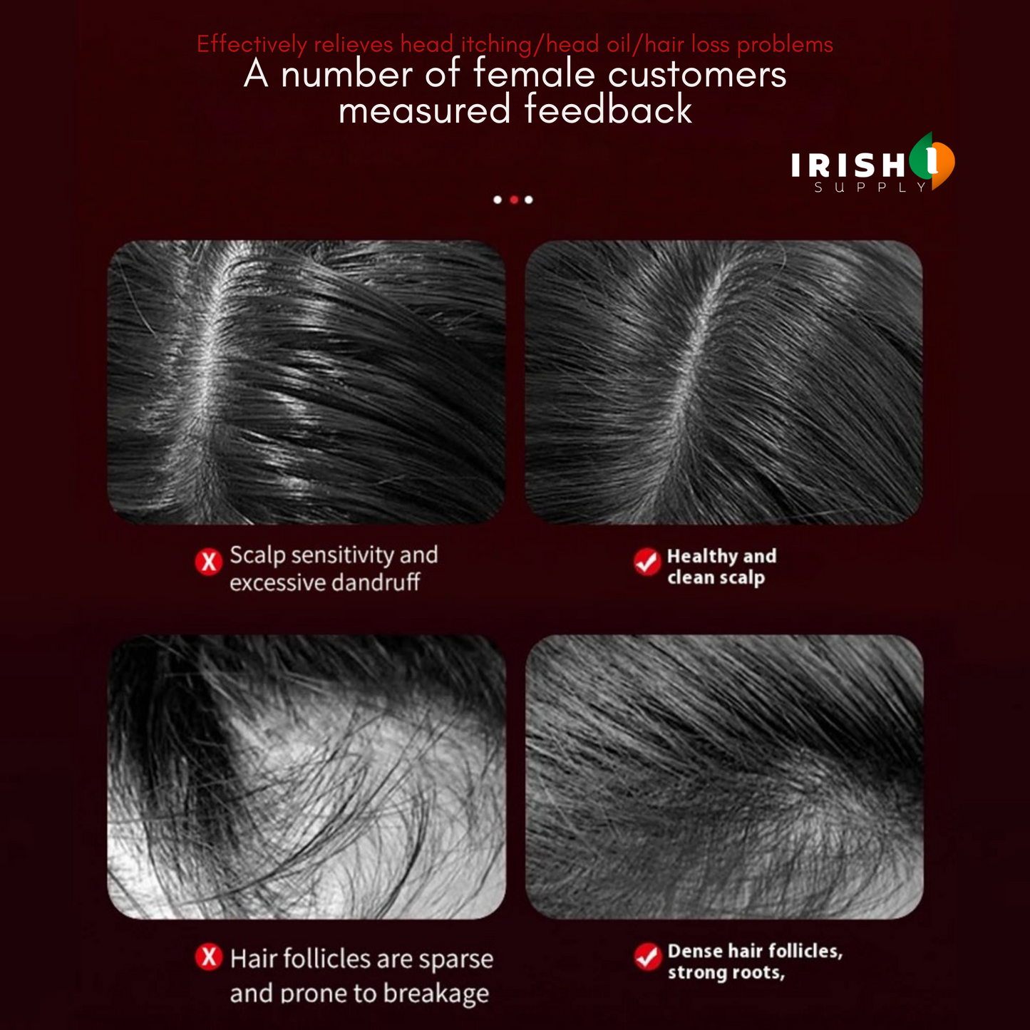 THERMACOMB Red Light Therapy Hair Growth Comb