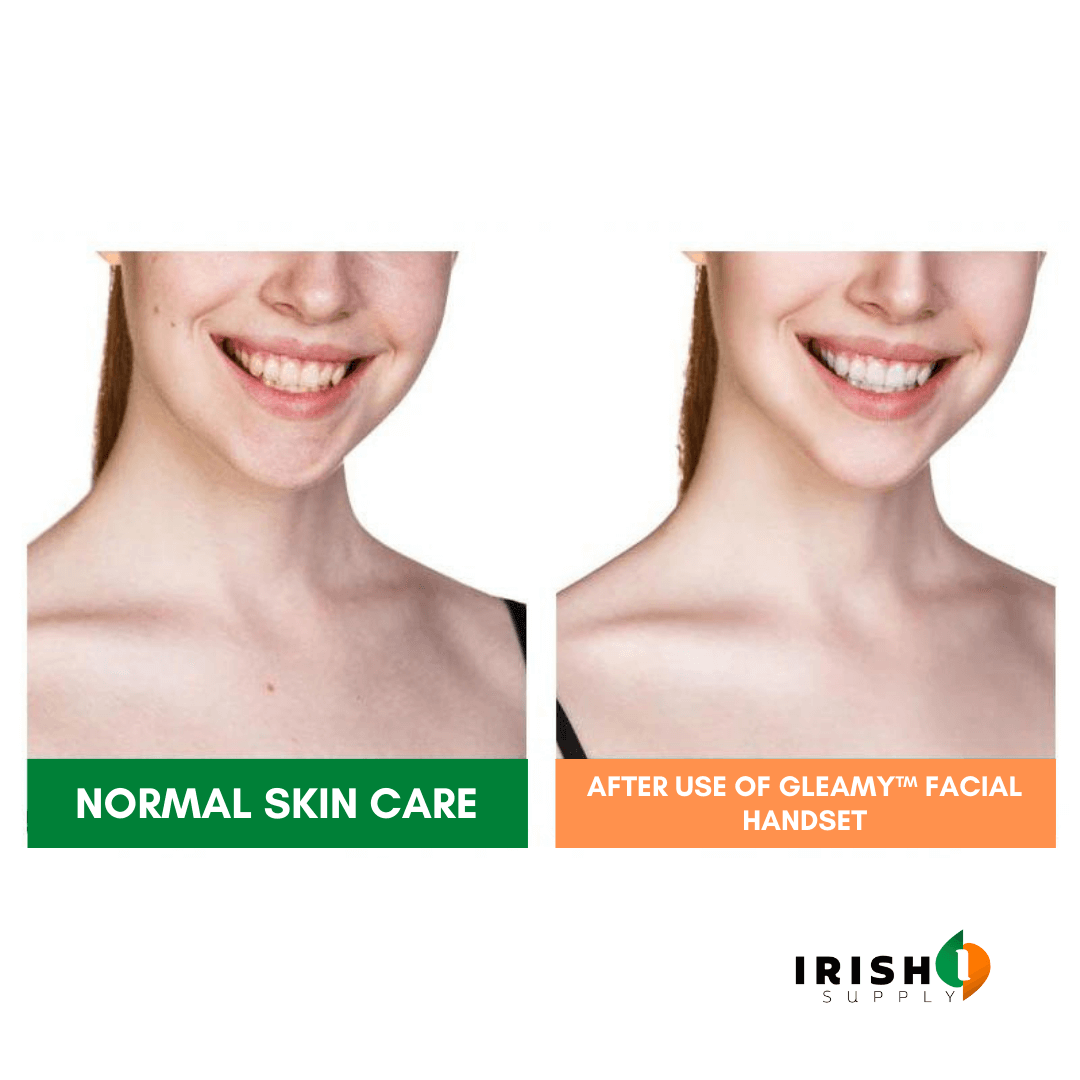 Irish Supply, GLEAMY Facial Handset